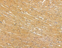 Invitrogen SLC10A4 Polyclonal Antibody 100 &mu;L; Unconjugated:Antibodies,