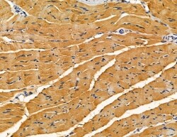 Invitrogen SLC10A4 Polyclonal Antibody 100 &mu;L; Unconjugated:Antibodies,