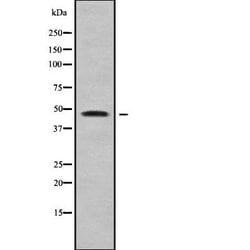 Invitrogen SLC10A4 Polyclonal Antibody 100 &mu;L; Unconjugated:Antibodies,