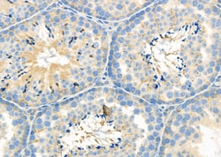 Invitrogen SLC9A10 Polyclonal Antibody 100 &mu;L | Buy Online | Invitrogen&trade; | Fisher Scientific