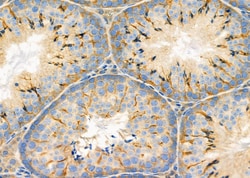 Invitrogen SLC9A11 Polyclonal Antibody 100 &mu;L; Unconjugated:Antibodies,