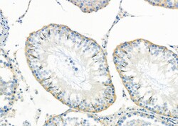 Invitrogen SLC9A11 Polyclonal Antibody 100 &mu;L; Unconjugated:Antibodies,