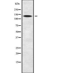 Invitrogen SLC9A11 Polyclonal Antibody 100 &mu;L; Unconjugated:Antibodies,