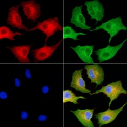 Invitrogen SLC28A1 Polyclonal Antibody 100 &mu;L; Unconjugated:Antibodies,