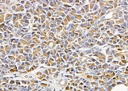 Invitrogen SLC24A2 Polyclonal Antibody 100 &mu;L | Buy Online | Invitrogen&trade; | Fisher Scientific
