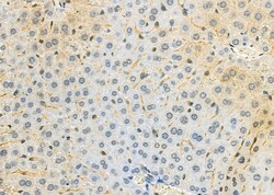 Invitrogen FXYD2 Polyclonal Antibody 100 &mu;L; Unconjugated:Antibodies,
