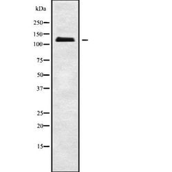 Invitrogen ATP1A3 Polyclonal Antibody 100 &mu;L | Buy Online | Invitrogen&trade; | Fisher Scientific