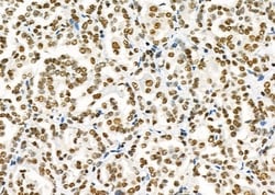 Invitrogen SFRS18 Polyclonal Antibody 100 &mu;L; Unconjugated:Antibodies,