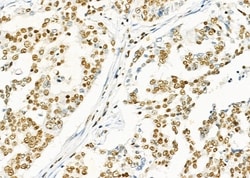Invitrogen SFRS18 Polyclonal Antibody 100 &mu;L; Unconjugated:Antibodies,