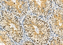 Invitrogen SFRS18 Polyclonal Antibody 100 &mu;L; Unconjugated:Antibodies,