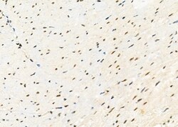 Invitrogen SFRS18 Polyclonal Antibody 100 &mu;L; Unconjugated:Antibodies,