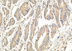 Invitrogen TBC1D2 Polyclonal Antibody 100 &mu;L; Unconjugated:Antibodies,
