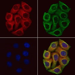 Invitrogen Tenascin X Polyclonal Antibody 100 &mu;L | Buy Online | Invitrogen&trade; | Fisher Scientific