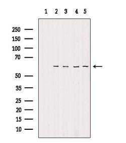 Invitrogen TIGD2 Polyclonal Antibody 100 &mu;L; Unconjugated:Antibodies,