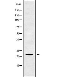 Invitrogen TM2D1 Polyclonal Antibody 100 &mu;L; Unconjugated:Antibodies,
