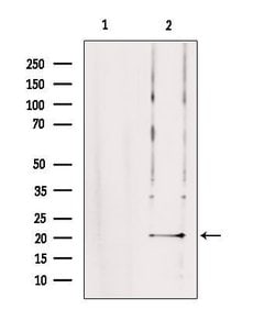 Invitrogen TRAPPC5 Polyclonal Antibody 100 &mu;L; Unconjugated:Antibodies,