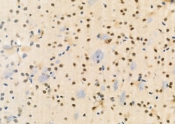 Invitrogen TCEAL2 Polyclonal Antibody 100 &mu;L; Unconjugated:Antibodies,
