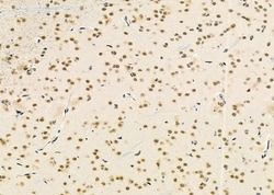 Invitrogen TCEAL2 Polyclonal Antibody 100 &mu;L; Unconjugated:Antibodies,