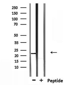 Invitrogen TCEAL5 Polyclonal Antibody 100 &mu;L; Unconjugated:Antibodies,