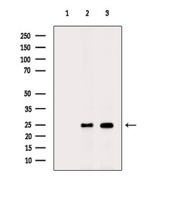 Invitrogen TCEAL8 Polyclonal Antibody 100 &mu;L; Unconjugated:Antibodies,