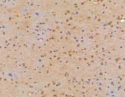 Invitrogen LSM2 Polyclonal Antibody 100 &mu;L; Unconjugated:Antibodies,