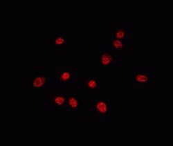 Invitrogen USP16 Polyclonal Antibody 100 &mu;L; Unconjugated:Antibodies,