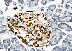 Invitrogen USP16 Polyclonal Antibody 100 &mu;L; Unconjugated:Antibodies,