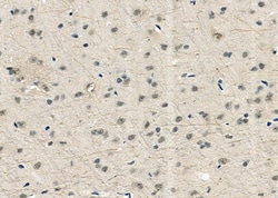 Invitrogen USP16 Polyclonal Antibody 100 &mu;L; Unconjugated:Antibodies,