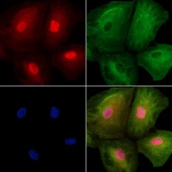 Invitrogen USP17L1 Polyclonal Antibody 100 &mu;L; Unconjugated:Antibodies,