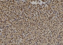 Invitrogen USP3 Polyclonal Antibody 100 &mu;L; Unconjugated:Antibodies,