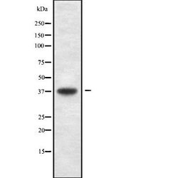 Invitrogen USP3 Polyclonal Antibody 100 &mu;L; Unconjugated:Antibodies,