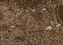 Invitrogen USP31 Polyclonal Antibody 100 &mu;L; Unconjugated:Antibodies,
