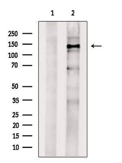 Invitrogen USP31 Polyclonal Antibody 100 &mu;L; Unconjugated:Antibodies,
