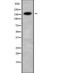 Invitrogen USP6 Polyclonal Antibody 100 &mu;L; Unconjugated:Antibodies,