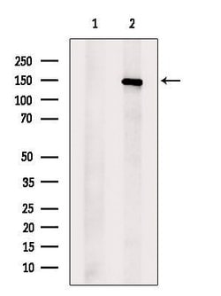 UBE4B Polyclonal Antibody:Antibodies, Polyclonal
