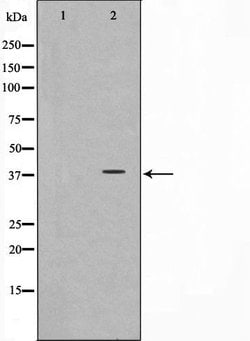 Invitrogen CD226 Polyclonal Antibody 100 &mu;L | Buy Online | Invitrogen&trade; | Fisher Scientific
