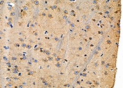 Invitrogen Nkx6.3 Polyclonal Antibody 100 &mu;L; Unconjugated:Antibodies,