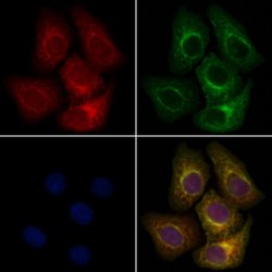 Invitrogen MEKK6 Polyclonal Antibody 100 &mu;L; Unconjugated:Antibodies,