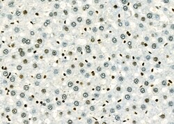 Invitrogen MEKK6 Polyclonal Antibody 100 &mu;L; Unconjugated:Antibodies,