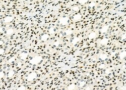 Invitrogen MEKK6 Polyclonal Antibody 100 &mu;L; Unconjugated:Antibodies,