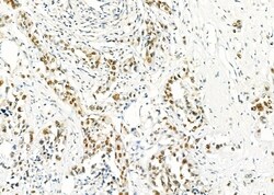 Invitrogen HEXIM1 Polyclonal Antibody 100 &mu;L; Unconjugated:Antibodies,