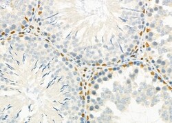 Invitrogen HEXIM1 Polyclonal Antibody 100 &mu;L; Unconjugated:Antibodies,