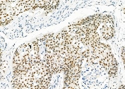 Invitrogen HEXIM1 Polyclonal Antibody 100 &mu;L; Unconjugated:Antibodies,