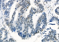 Invitrogen HEXIM1 Polyclonal Antibody 100 &mu;L; Unconjugated:Antibodies,