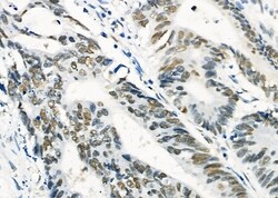 Invitrogen HEXIM1 Polyclonal Antibody 100 &mu;L; Unconjugated:Antibodies,