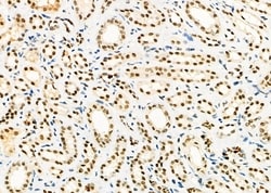 Invitrogen HEXIM1 Polyclonal Antibody 100 &mu;L; Unconjugated:Antibodies,