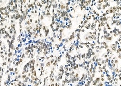 Invitrogen HEXIM1 Polyclonal Antibody 100 &mu;L; Unconjugated:Antibodies,