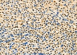 Invitrogen HEXIM1 Polyclonal Antibody 100 &mu;L; Unconjugated:Antibodies,