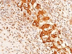 Invitrogen Phospho-Chk1 (Ser296) Polyclonal Antibody 100 &mu;L | Buy Online | Invitrogen&trade; | Fisher Scientific