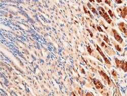 Invitrogen Phospho-Chk1 (Ser296) Polyclonal Antibody 100 &mu;L | Buy Online | Invitrogen&trade; | Fisher Scientific